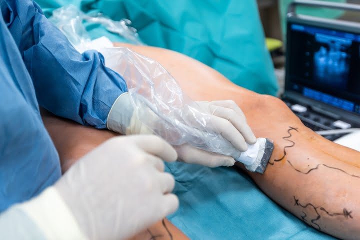 Vascular HSL Vascular HSL